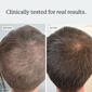 Densifying Scalp Serum thumbnail